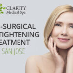 Non-Surgical Skin Tightening in San Jose