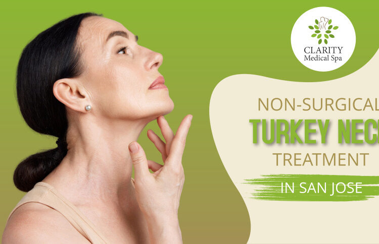 Nonsurgical Turkey Neck Treatment in San Jose