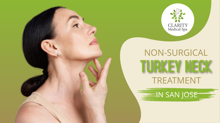 Nonsurgical Turkey Neck Treatment in San Jose