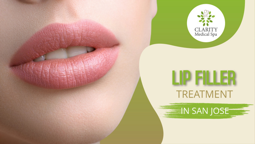 Lip Fillers in San Jose