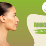 Rhinoplasty in San Jose