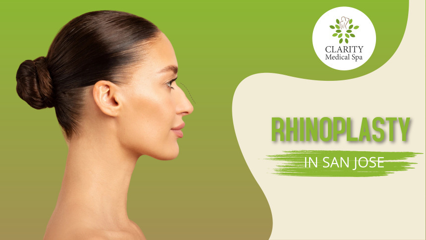 Rhinoplasty in San Jose